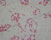 Bacteria gram stain