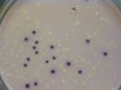 Coliforms (purple) growing on differential media